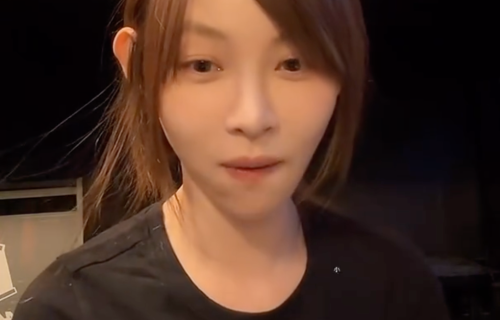 痞幼自曝做了“妈妈臀”吸脂手术，四个屁股很尴尬，术后体重反增