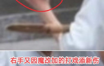 杨洋带伤拍戏是真的吗？