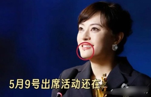 孙俪去除痣后的最新形象和影视作品状态如何？