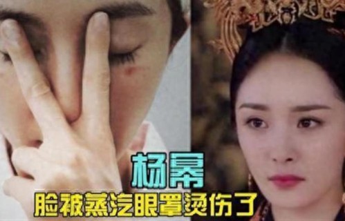 杨幂脸部遭烫伤！网友后怕：我每次都是戴着睡觉，再也不敢了